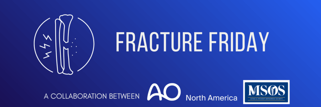 FRACTURE FRIDAY