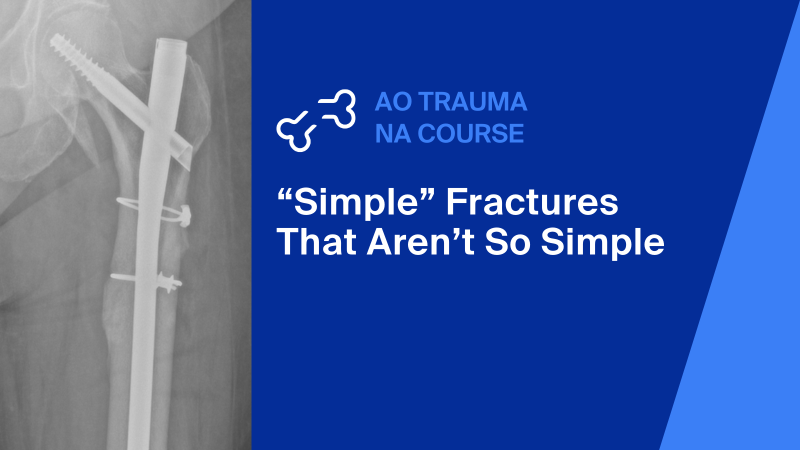 Simple Fractures That Aren’t So Simple—Advanced Course for General Orthopedic Surgeons